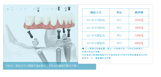 澳門all on 4全口重建費用